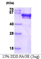 Human FKBP4 / FKBP52 Protein (Recombinant His)