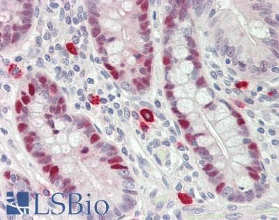 PathPlus™ Polyclonal Rabbit anti-Human PCNA Antibody (aa61-110, IHC, WB)