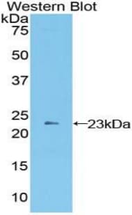 AGER / RAGE Antibody (aa10-188)