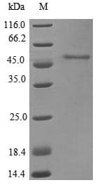 Chimpanzee ASAH1 / Acid Ceramidase Protein (Recombinant 10His, N-terminus + Myc, C-terminus)