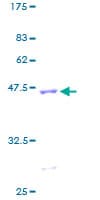 Human CD247 / CD3 Zeta Protein (Recombinant GST)
