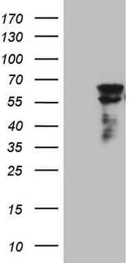CLU / Clusterin Antibody (aa23-227, clone OTI2A7)