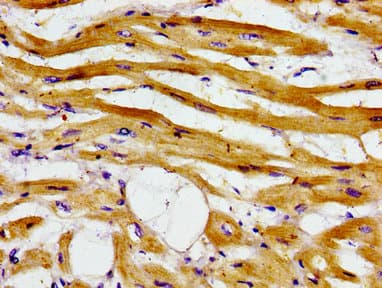 ADCY6 / Adenylate Cyclase 6 Antibody
