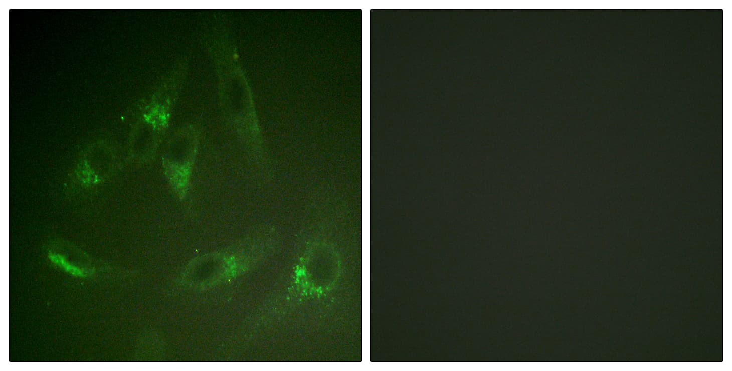 Polyclonal Rabbit anti-Human CSF1R / CD115 / FMS Antibody (aa531-580, IHC, IF)