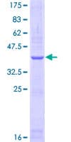 Human NPRA / NPR1 Protein (Recombinant GST, N-terminus)