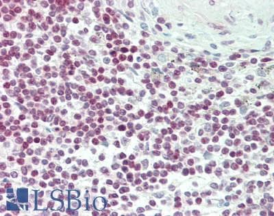 IHC-plus™ KDM4D / JMJD2D Antibody (aa484-516)