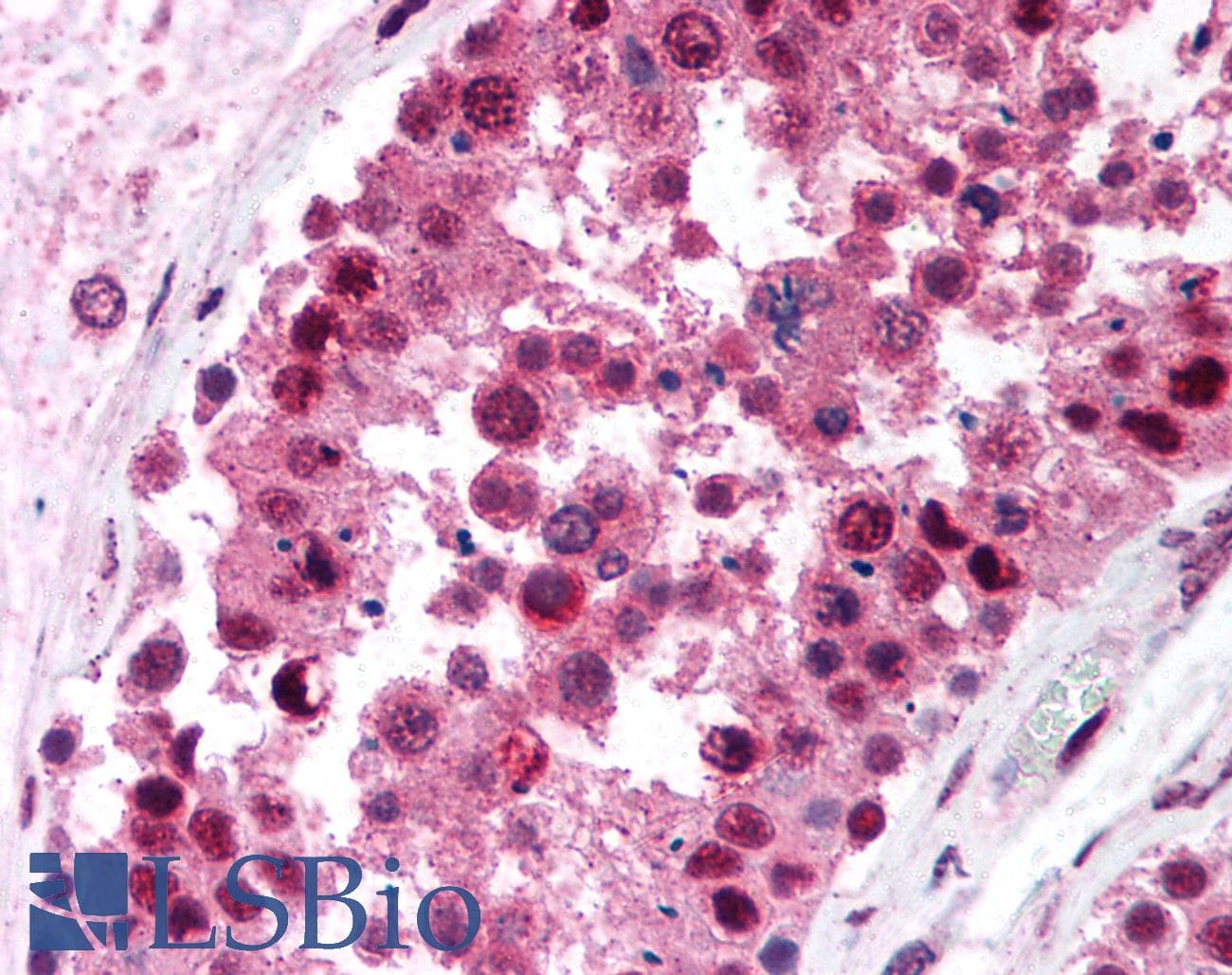 IHC-plus™ RBBP4 / RBAP48 Antibody (aa1-425, clone 11G10)