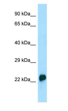 CRYGA Antibody (aa35-84)