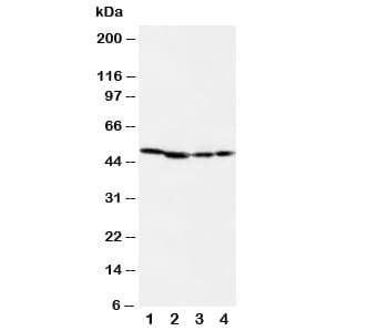 MAP2K1 / MKK1 / MEK1 Antibody (aa353-367)