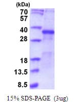Human SFRP5 Protein (Recombinant His)