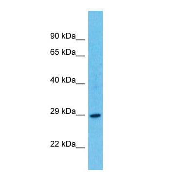 TARM1 Antibody (C-Terminus)