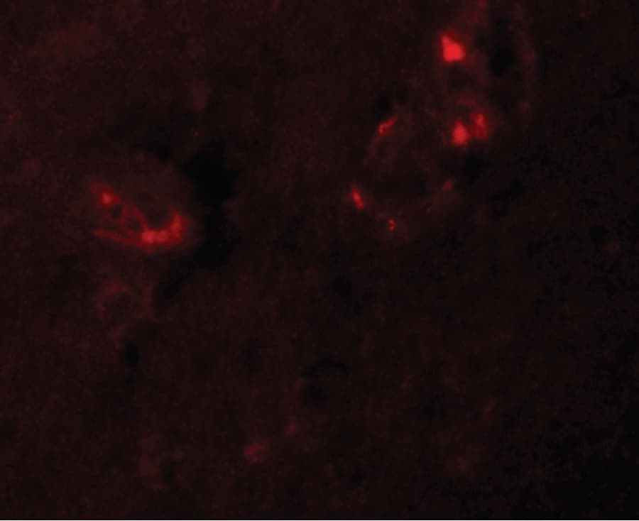 NLRP5 / NALP5 Antibody