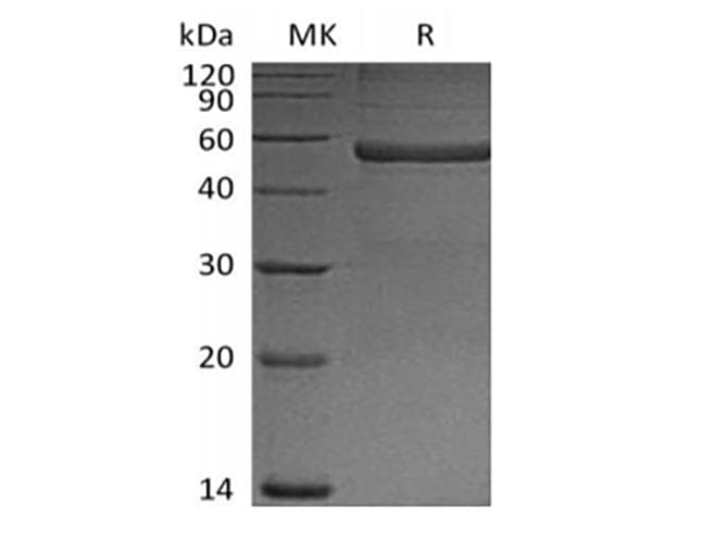 Mouse PTX3 / Pentraxin 3 Protein (Recombinant 6His, N-terminus)