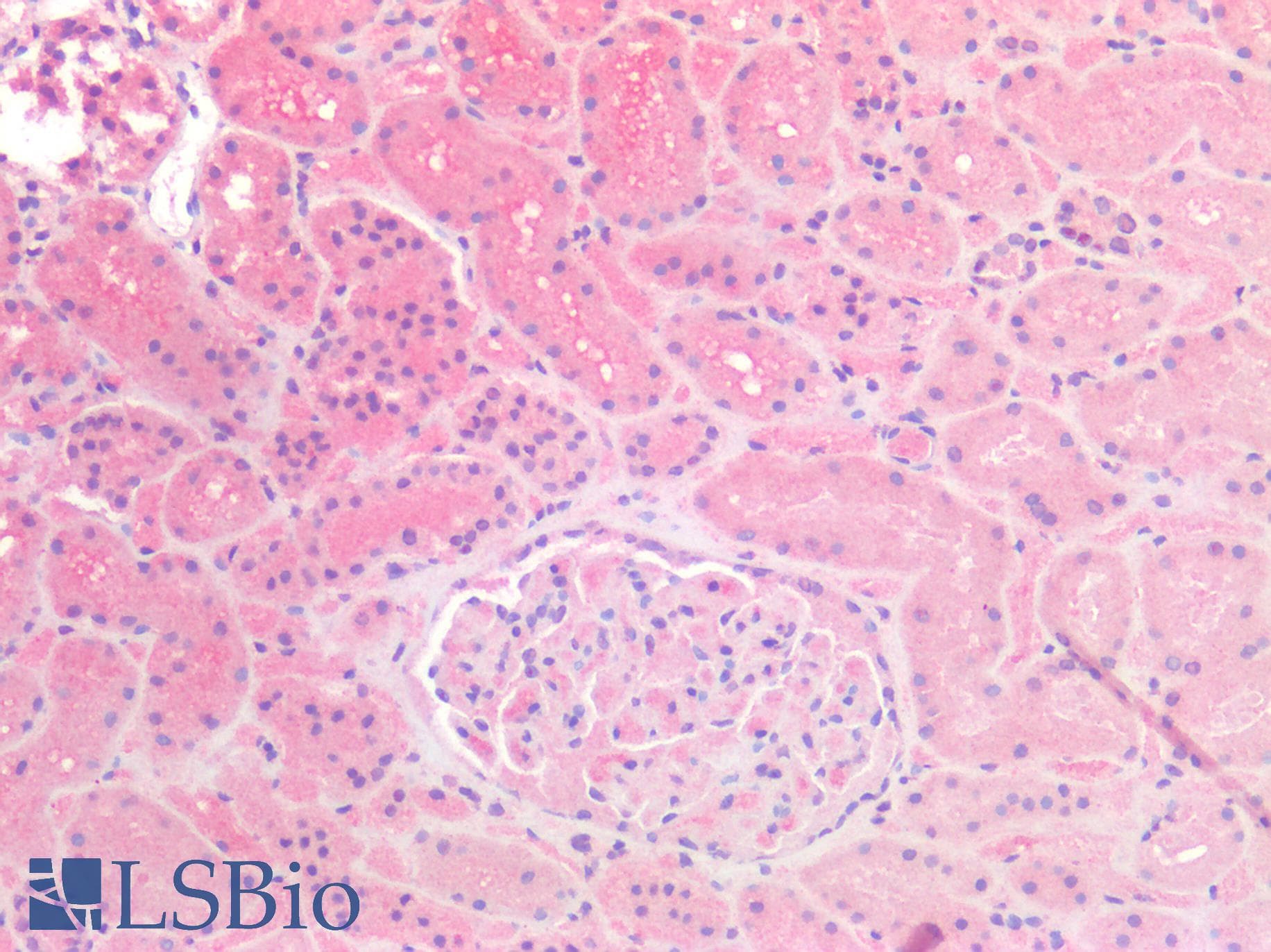 IHC-plus™ Polyclonal Goat anti-Human CAT / Catalase Antibody (IHC, WB)