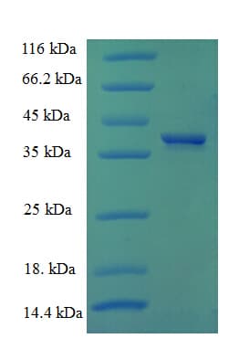 Human CCND1 / Cyclin D1 Protein (Recombinant 6His, N-terminus)