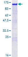 Human NFE2L2 / NRF2 Protein (Recombinant GST)