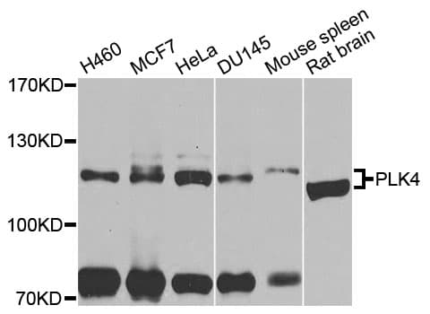 PLK4 / SAK Antibody