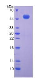Mouse Complement C9 Protein (Recombinant His-T7)