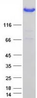 Human FLNA / Filamin A Protein (Recombinant Myc-DDK (Flag))