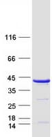Human TBCC Protein (Recombinant Myc-DDK (Flag))