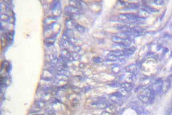 Polyclonal Rabbit anti-Human PLCG2 / PLC Gamma 2 Antibody (phospho-Tyr753, IHC, WB)