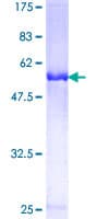 Human OTUB1 / OTU1 Protein (Recombinant GST)