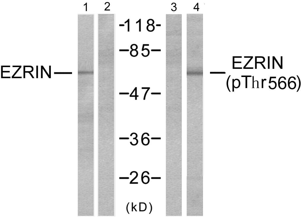 Polyclonal Rabbit anti-Human EZR / Ezrin Antibody (phospho-Thr566, WB)