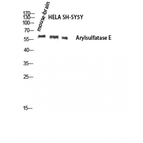 ARSE / Arylsulfatase E Antibody (120-200 aa, Internal)
