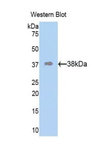 KRT10 / CK10 / Cytokeratin 10 Antibody (aa153-456, Cy3)