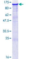 Human DLG4 / PSD95 Protein (Recombinant GST)