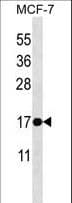 BAX Antibody (aa28-56)