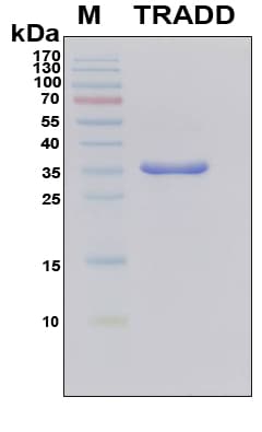 Human TRADD Protein (Recombinant 6His, N-terminus)
