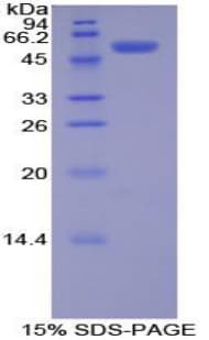 Rat PDGF-BB Protein (Recombinant His-GST)