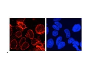 NUP210 / gp210 Antibody (N-Terminus)