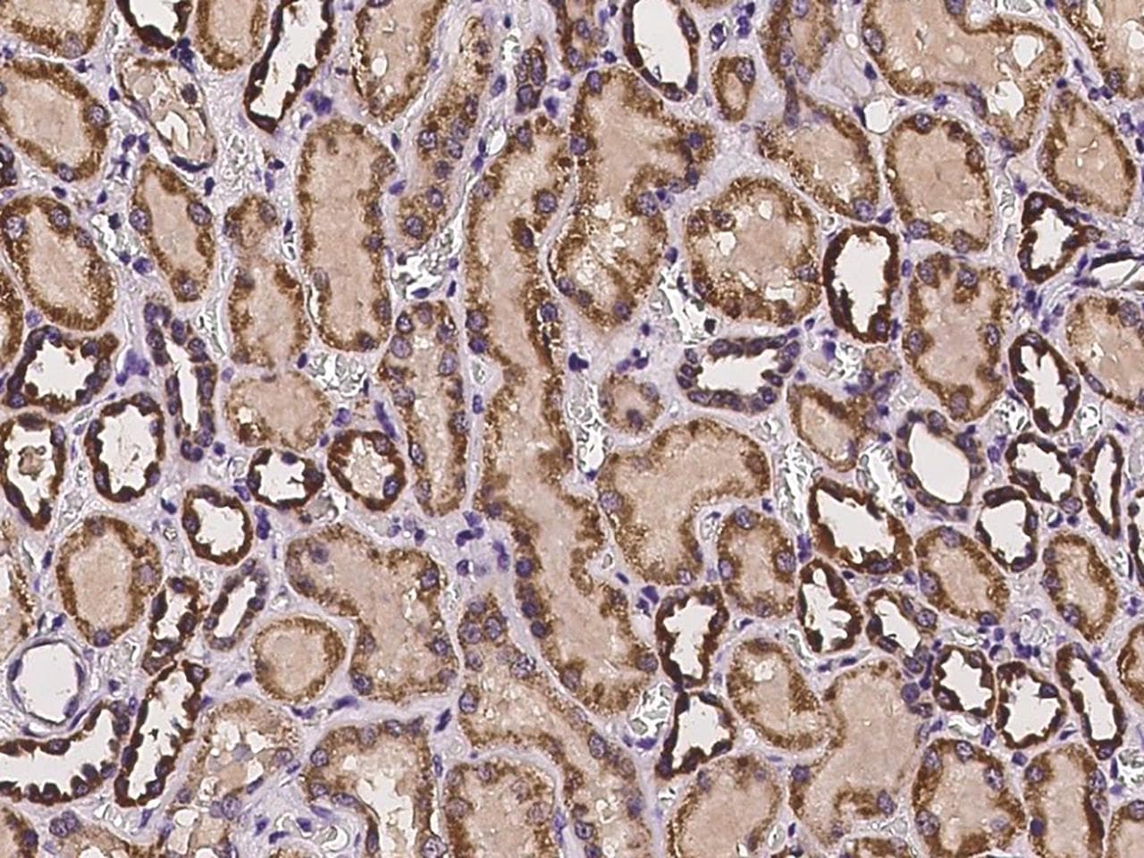 DARS2 Antibody