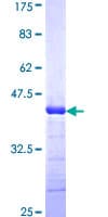 Human ADAMTS2 Protein (Recombinant GST, N-terminus)