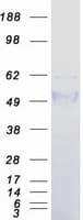 Human TCN1 Protein (Recombinant Myc-DDK (Flag))