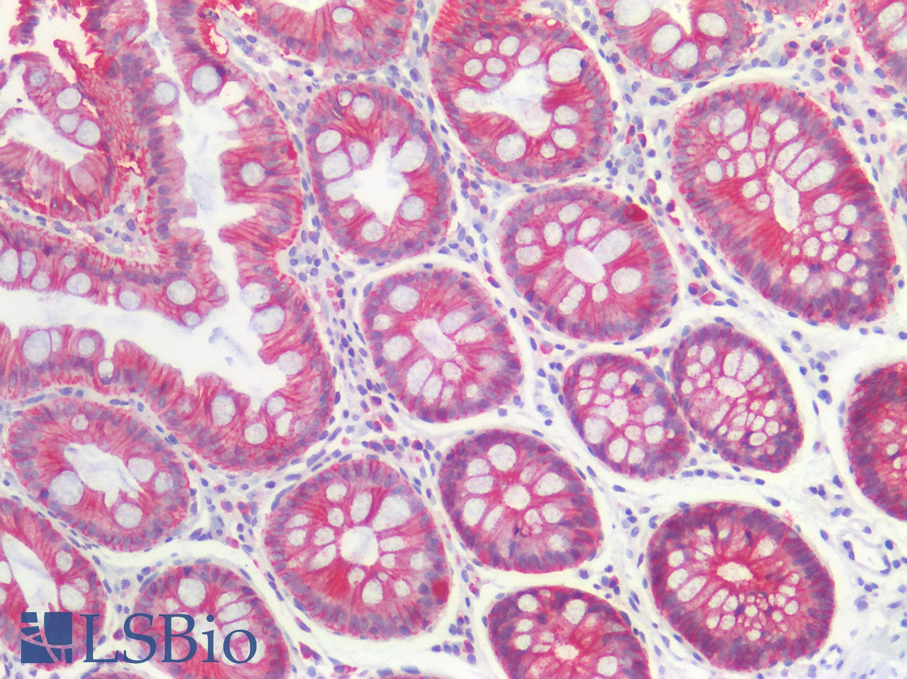 PathPlus™ Polyclonal Rabbit anti-Human CLDN3 / Claudin 3 Antibody (C-Terminus, IHC, IF, WB)