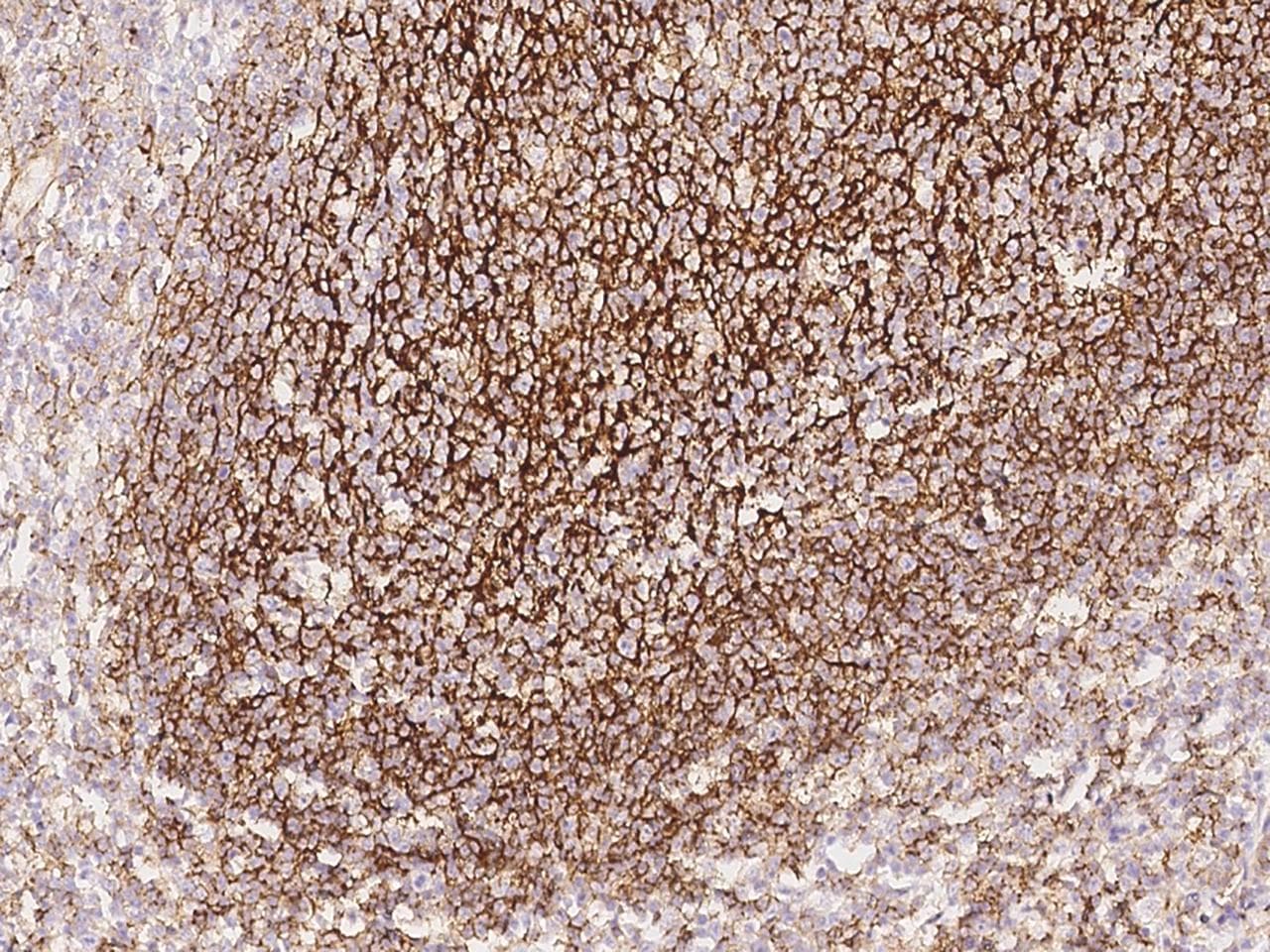 CR2 / CD21 Antibody