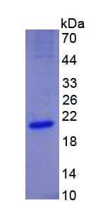 Human Endostatin Protein (Recombinant His, N-Terminal)