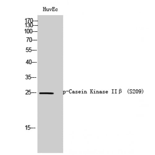 Polyclonal Rabbit anti-Human CSNK2B / Phosvitin Antibody (140-220 aa, IHC, WB)