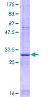Human CLDN5 / Claudin 5 Protein (Recombinant GST, N-terminus)