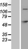 Human GAD65 Protein (Over-Expression Lysate Myc-DDK (Flag))