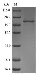 Mouse Fibulin-3 / EFEMP1 Protein (Recombinant 6His, N-terminus)