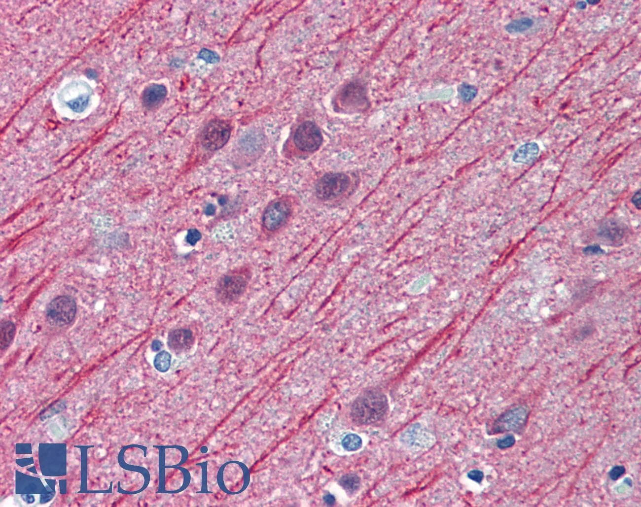 IHC-plus™ TUBB2A / Tubulin Beta 2A Antibody (clone 4C8)