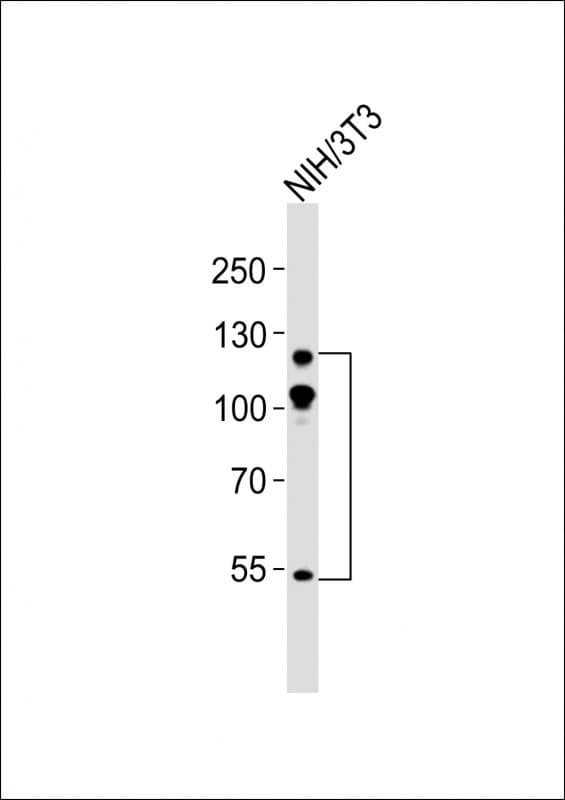 Monoclonal Mouse anti-Human ABL2 Antibody (clone 1442CT175.30.33, WB)