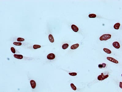 HIST1H2BB Antibody