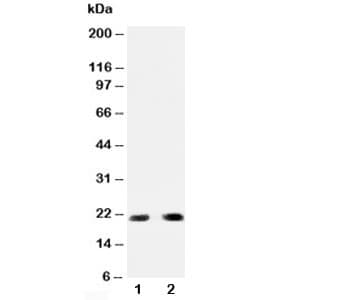 BBC3 / PUMA Antibody (aa145-159)