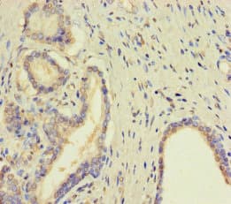 Polyclonal Rabbit anti-Human TMPRSS11D / HAT Antibody