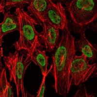 PSIP1 / LEDGF Antibody (clone 60000)